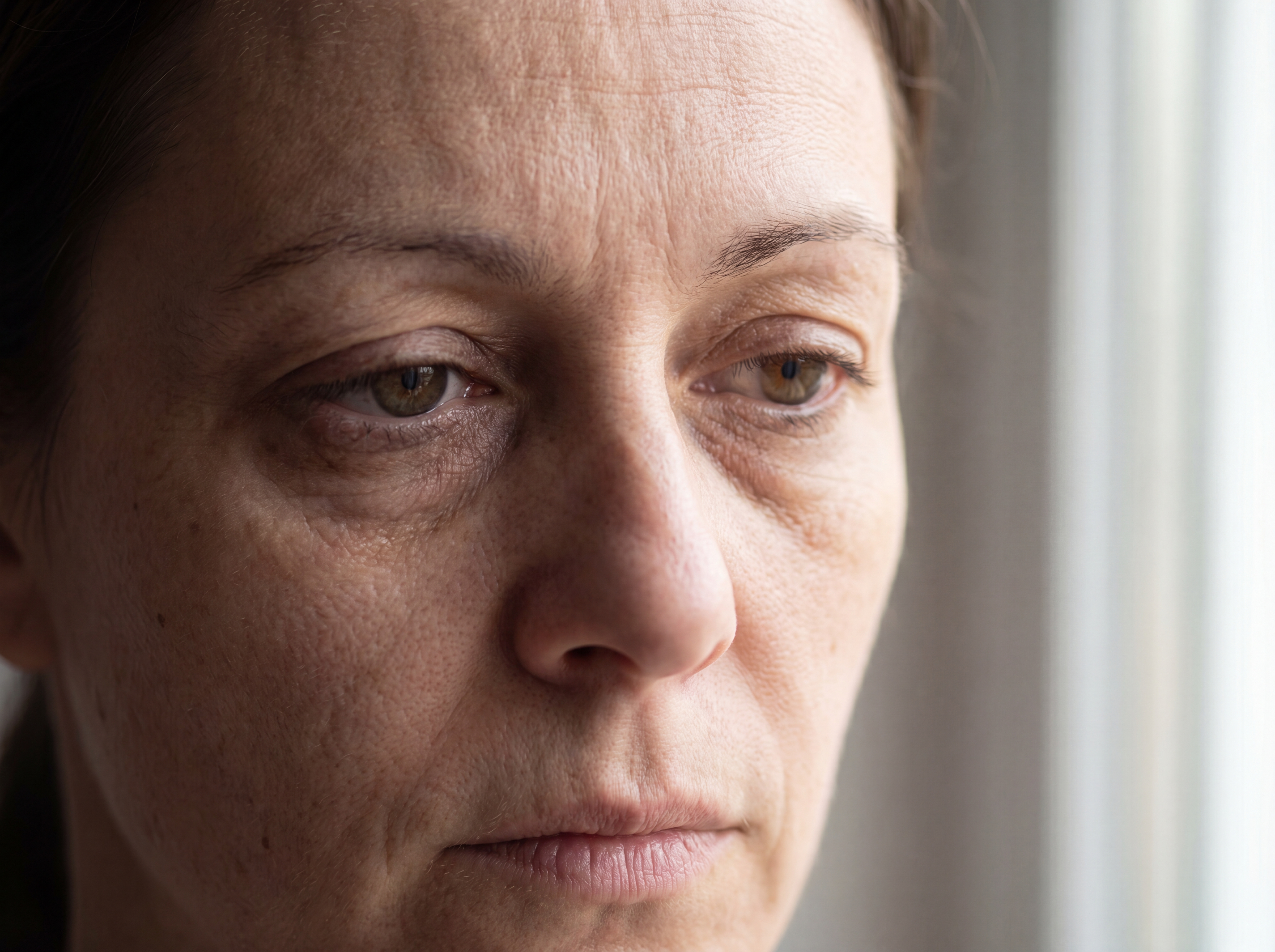 Close-up of a tired aging eye area with under-eye bags, dark circles and fine lines